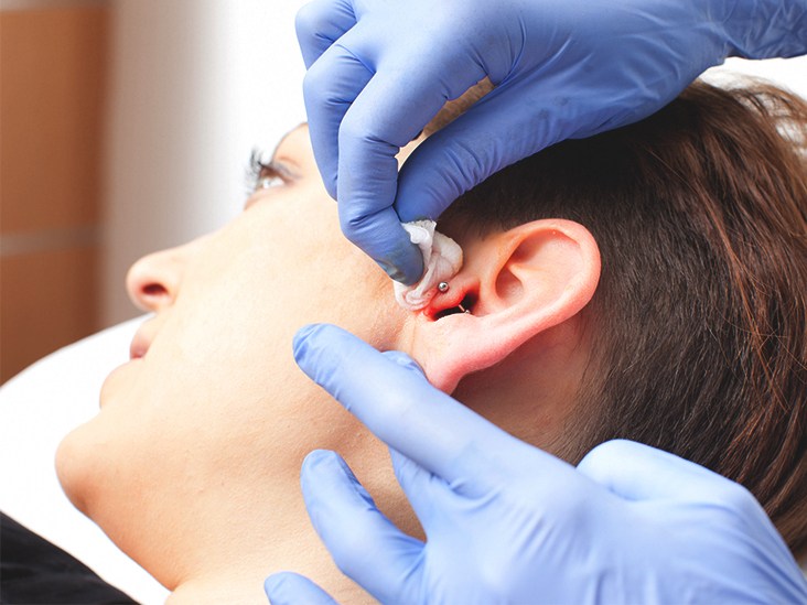 Léčení infikovaných tragus piercing